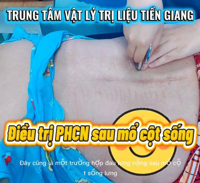 SAI LẦM PHỔ BIẾN SAU MỔ CỘT SỐNG