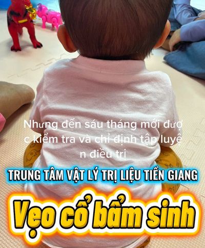 ĐỪNG ĐỂ LỠ "THỜI GIAN V&Agrave;NG" ĐIỀU TRỊ VẸO CỔ BẨM SINH CHO B&Eacute;