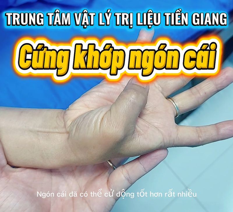 3 TH&Aacute;NG KH&Ocirc;NG CO ĐƯỢC NG&Oacute;N C&Aacute;I &ndash; PHỤC HỒI KỲ DIỆU CHỈ SAU V&Agrave;I NG&Agrave;Y