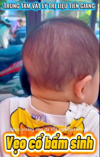 VẸO CỔ BẨM SINH - CH&Uacute;C MỪNG CON Đ&Atilde; TỐT NGHIỆP!