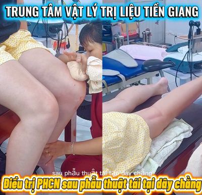 TẬP PHỤC HỒI SAU MỔ D&Acirc;Y CHẰNG: Đ&Uacute;NG THỜI ĐIỂM &ndash; Đ&Uacute;NG CƯỜNG ĐỘ
