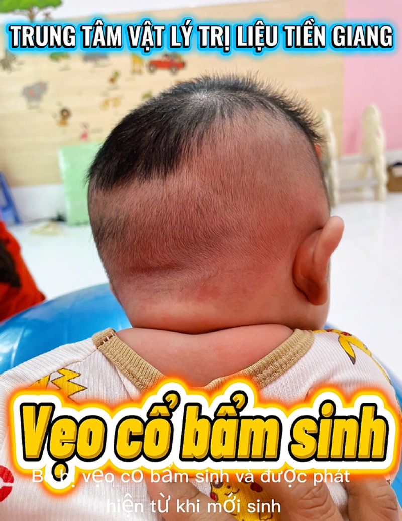 TỰ TẬP VẸO CỔ TẠI NH&Agrave; CHO B&Eacute;: Đ&Uacute;NG NHƯNG LIỆU Đ&Atilde; ĐỦ?