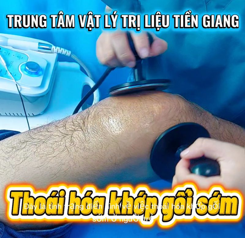 THO&Aacute;I H&Oacute;A KHỚP GỐI SỚM Ở NGƯỜI TRẺ