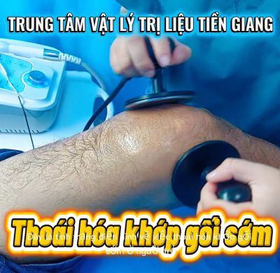 THO&Aacute;I H&Oacute;A KHỚP GỐI SỚM Ở NGƯỜI TRẺ