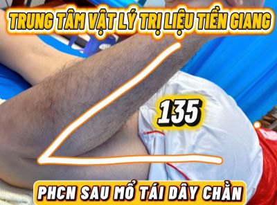 PHỤC HỒI CHỨC NĂNG SAU PHẪU THUẬT T&Aacute;I TẠO D&Acirc;Y CHẰNG: H&Atilde;Y TẬP LUYỆN NGAY SAU KHI CẮT CHỈ!