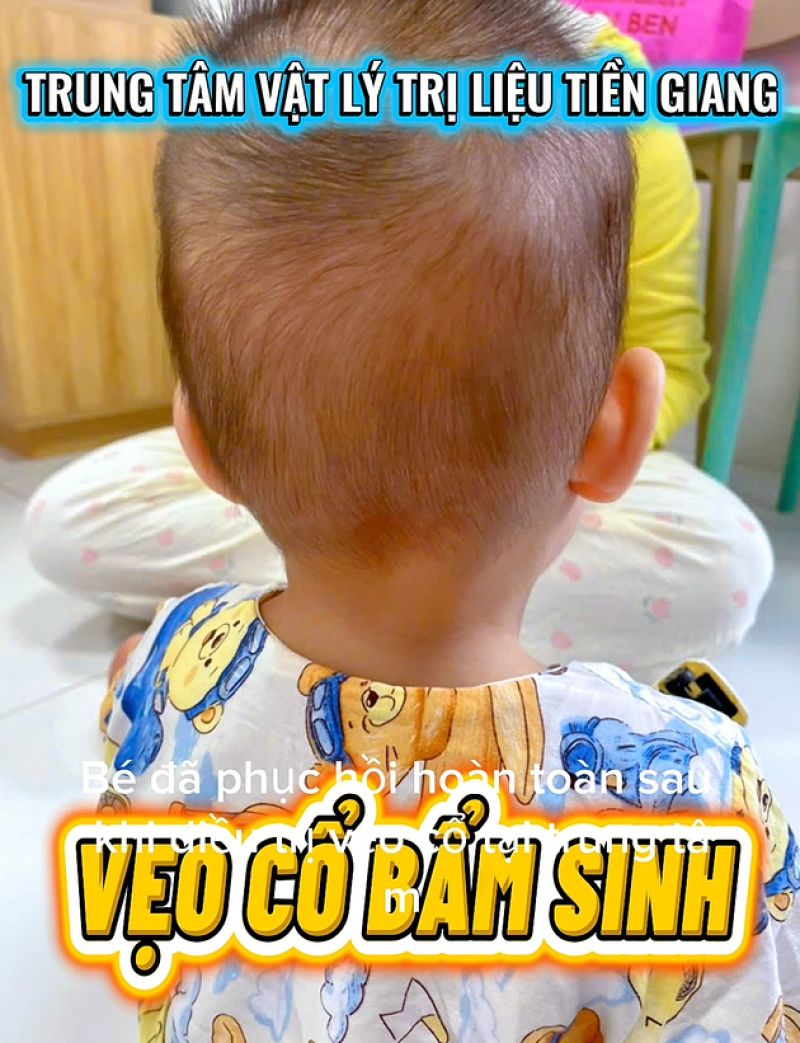 VẸO CỔ BẨM SINH - CH&Uacute;C MỪNG CON Đ&Atilde; PHỤC HỒI HO&Agrave;N TO&Agrave;N SAU 10 BUỔI ĐIỀU TRỊ