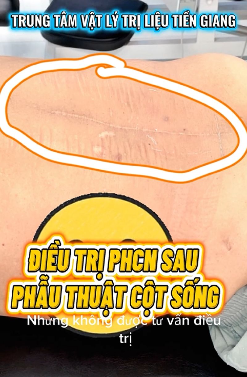 SAU PHẪU THUẬT CỘT SỐNG: V&Igrave; SAO VẾT MỔ Đ&Atilde; L&Agrave;NH NHƯNG LƯNG VẪN ĐAU YẾU?